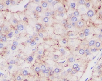 LAMP2 Rabbit mAb [KD Validated] Antibody