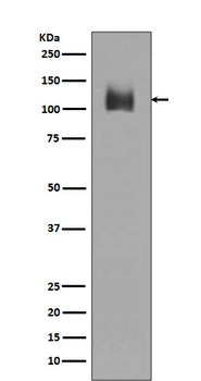LAMP2 Rabbit mAb [KD Validated] Antibody