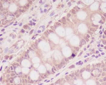 M6PR Rabbit mAb Antibody