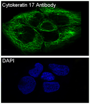 Cytokeratin 17 Rabbit mAb Antibody