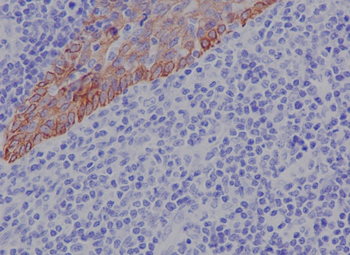 Cytokeratin 17 Rabbit mAb Antibody