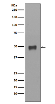 Cytokeratin 17 Rabbit mAb Antibody