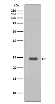 Rab9 Rabbit mAb [KD Validated] Antibody