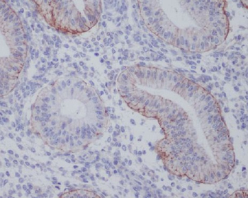 Integrin alpha 6 Rabbit Monoclonal Antibody