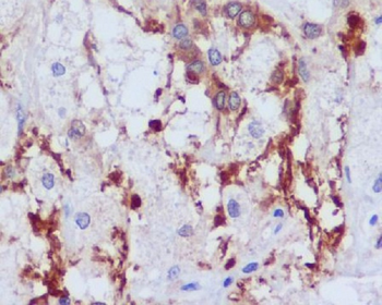 PI 3 Kinase p55 gamma Rabbit mAb Antibody