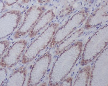 active + pro Caspase 3  Rabbit mAb  [KD Validated]