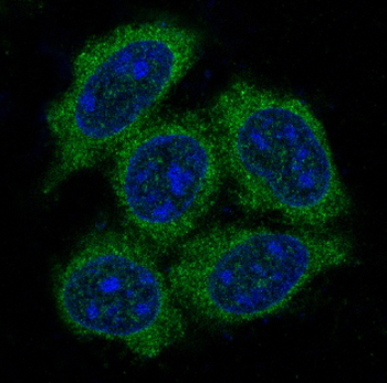 Hsp70 Rabbit mAb Antibody