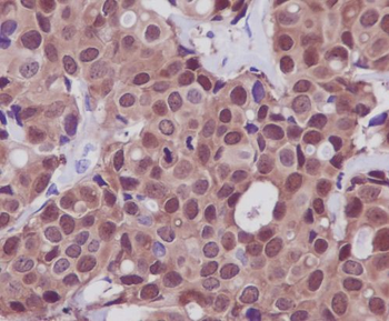 Hsp70 Rabbit mAb Antibody