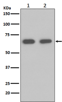 Hsp70 Rabbit mAb Antibody