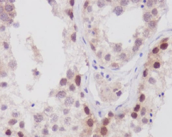 NUP98 Rabbit mAb Antibody