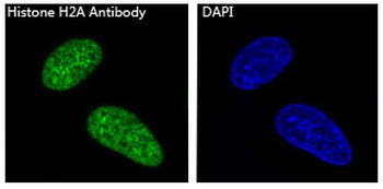 Histone H2A Rabbit mAb Antibody