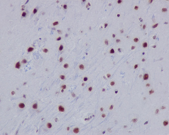 Histone H2A (acetyl K9) Rabbit mAb Antibody