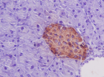 Insulin Rabbit mAb Antibody