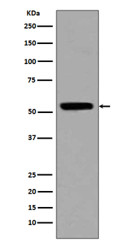 p53 (acetyl K370) Rabbit mAb Antibody