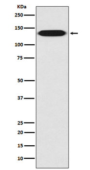 Integrin beta 1 Rabbit mAb [KD Validated]