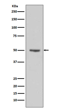 Cyclin E1 Rabbit mAb Antibody