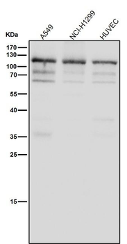 FAK Rabbit mAb Antibody
