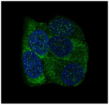 YB1 Rabbit mAb Antibody
