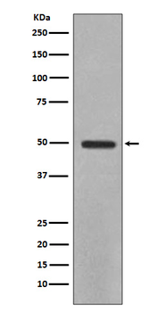 YB1 Rabbit mAb