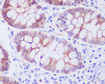 Stathmin 1 Rabbit mAb Antibody