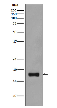 Stathmin 1 Rabbit mAb