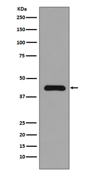 MEK1 Rabbit mAb Antibody