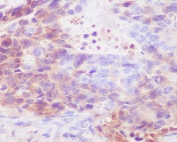Human IgG4 Rabbit Monoclonal Antibody
