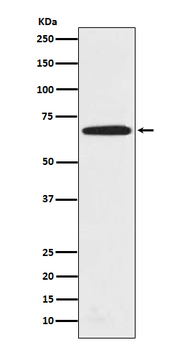 PRMT5 Rabbit mAb