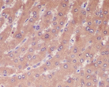 Caspase-1 Rabbit Monoclonal Antibody