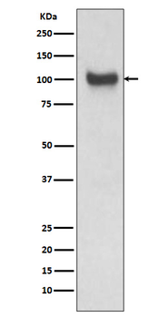 VCAM1 Rabbit mAb