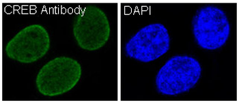 CREB Rabbit mAb Antibody