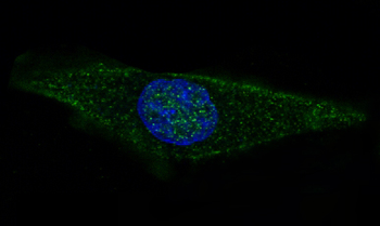 GFAP Rabbit mAb Antibody