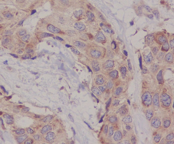Hsc70  Rabbit mAb  [KD Validated]