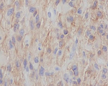 NGFR Rabbit mAb Antibody