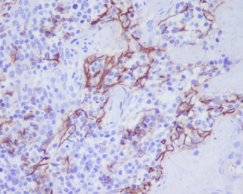 CD31 Rabbit mAb Antibody