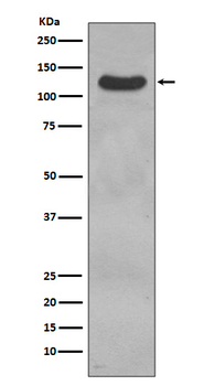 CD31 Rabbit mAb Antibody