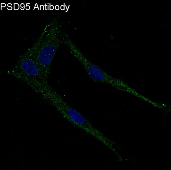 PSD95 Rabbit mAb Antibody