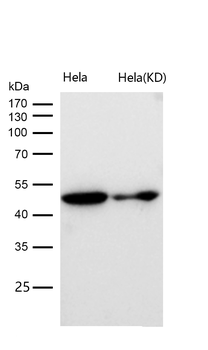 Tubulin gamma Rabbit mAb [KD Validated]