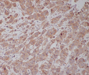 Tubulin gamma Rabbit mAb [KD Validated]