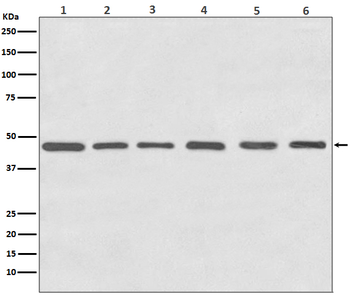 Tubulin gamma Rabbit mAb [KD Validated]