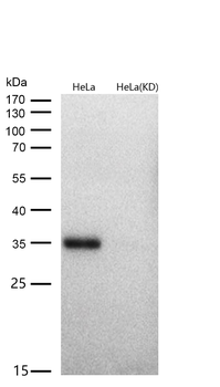 Cyclin D1 Rabbit mAb [KD Validated] Antibody