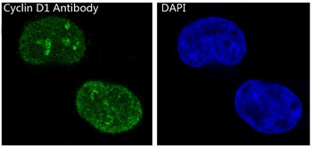 Cyclin D1 Rabbit mAb [KD Validated] Antibody