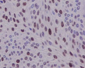 Cyclin D1 Rabbit mAb [KD Validated] Antibody