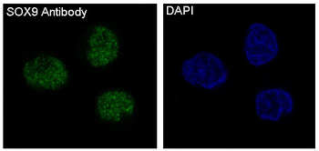 SOX9 Rabbit mAb Antibody