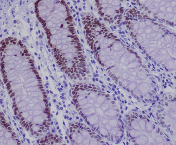 SOX9 Rabbit mAb Antibody