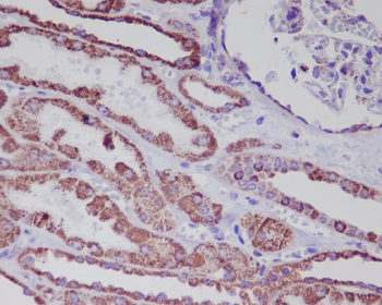 Hsp60 Rabbit mAb [KD Validated] Antibody