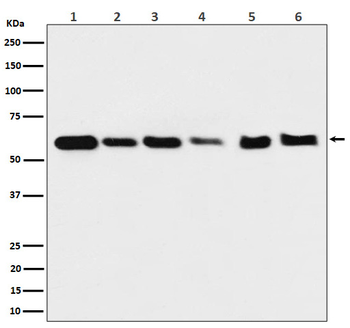 Hsp60 Rabbit mAb [KD Validated] Antibody