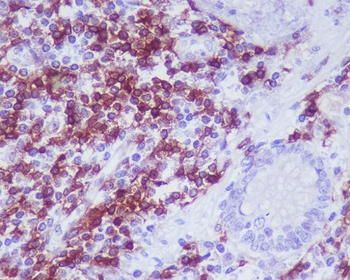 CD4 Rabbit mAb Antibody