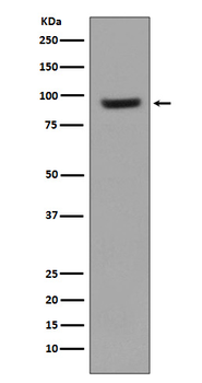 ICAM1 Rabbit mAb Antibody