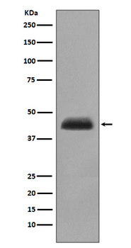 Cytokeratin 15 Rabbit mAb Antibody